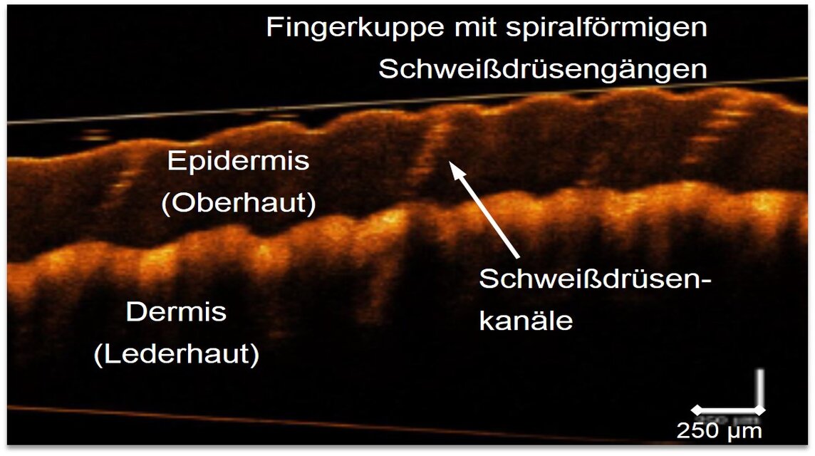 Bildgebendes Verfahren