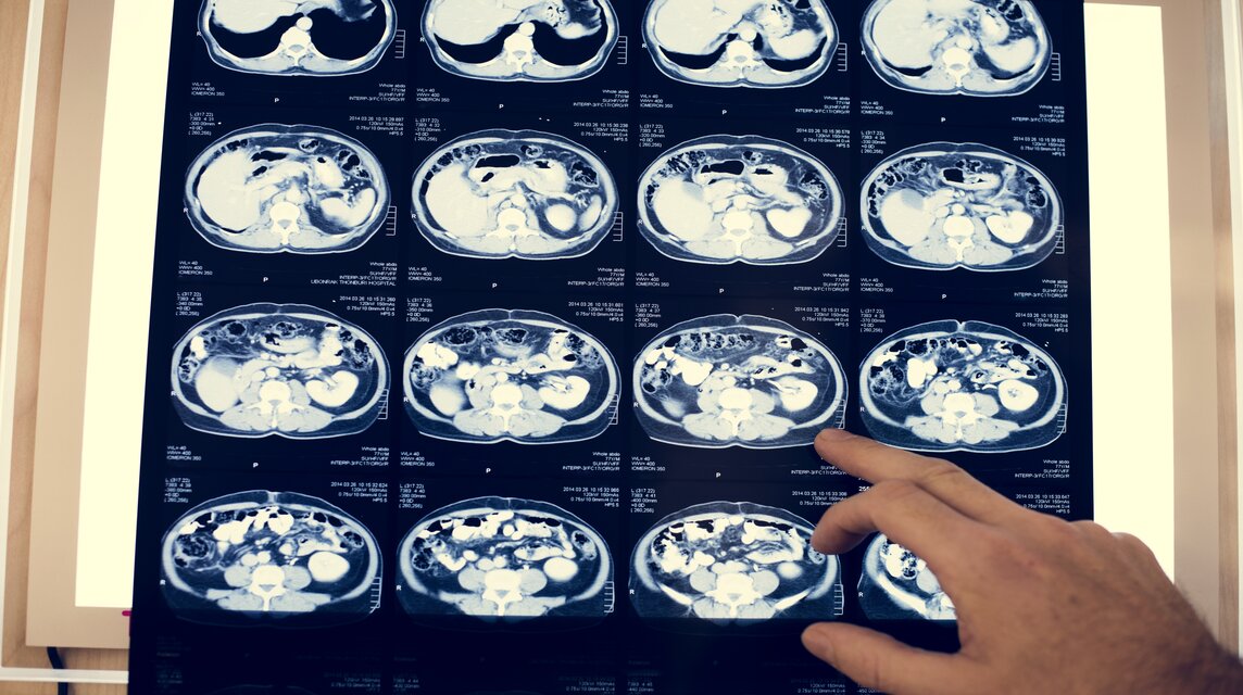 Negativ Bild von einem Kopf CT.