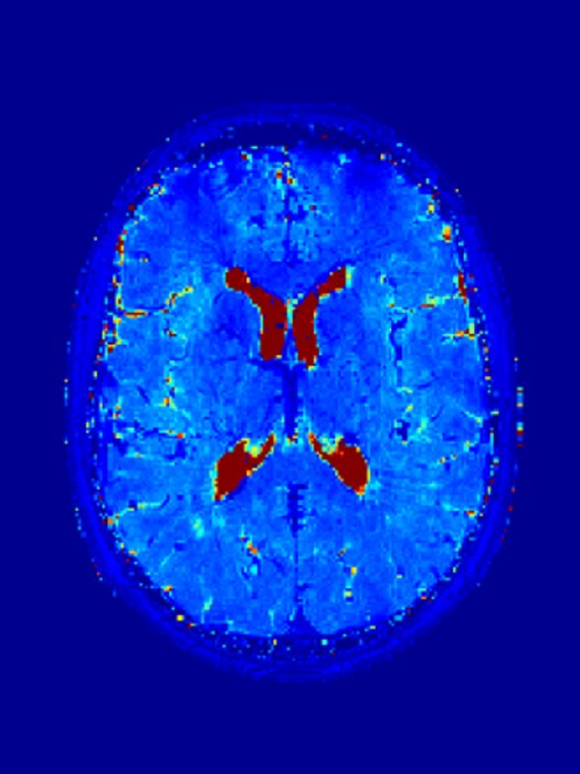 Quantitative MRI