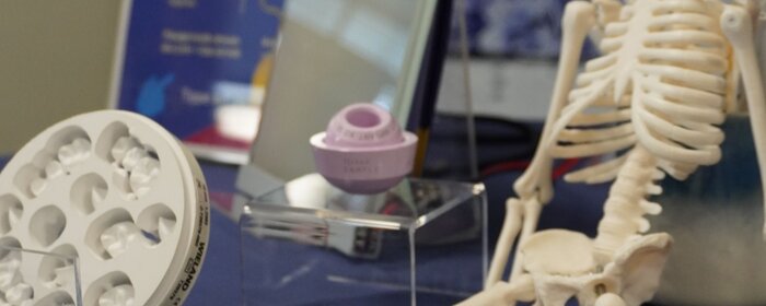 Teile z.B. ein Mini-Sklett aus Keramik